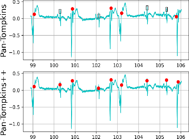 Figure 4 for Pan-Tompkins++: A Robust Approach to Detect R-peaks in ECG Signals