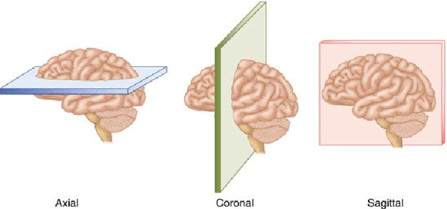 Figure 1 for Using U-Net Network for Efficient Brain Tumor Segmentation in MRI Images