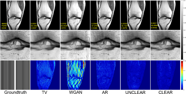 Figure 2 for Convex Latent-Optimized Adversarial Regularizers for Imaging Inverse Problems