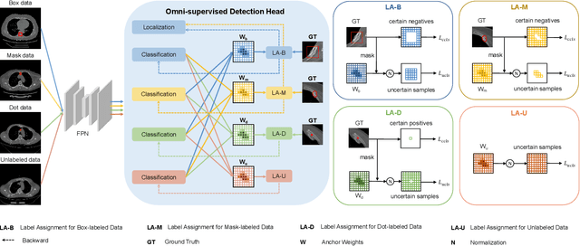 Figure 2 for Deep Omni-supervised Learning for Rib Fracture Detection from Chest Radiology Images