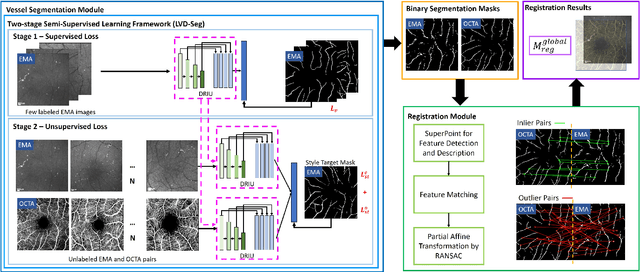 Figure 4 for MEMO: Dataset and Methods for Robust Multimodal Retinal Image Registration with Large or Small Vessel Density Differences