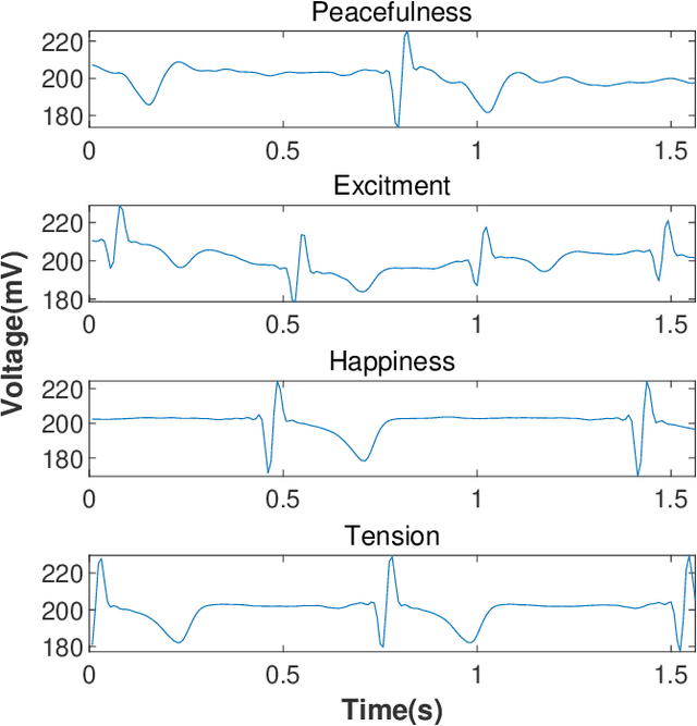 Figure 1 for A Novel Exploitative and Explorative GWO-SVM Algorithm for Smart Emotion Recognition