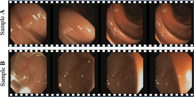 Figure 2 for Towards Discriminative Representation with Meta-learning for Colonoscopic Polyp Re-Identification