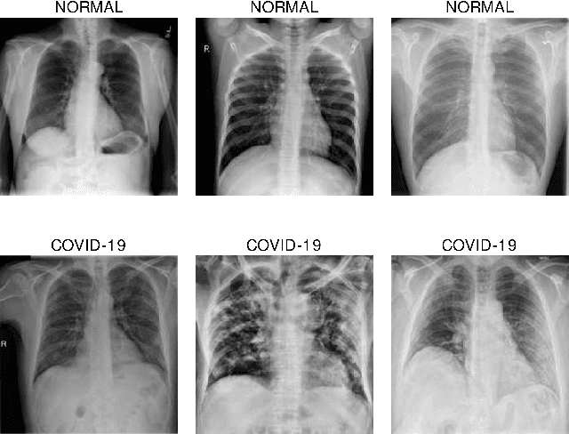 Figure 1 for Privacy in Practice: Private COVID-19 Detection in X-Ray Images