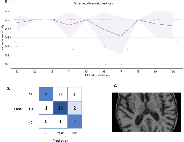 Figure 2 for Prior-knowledge-informed deep learning for lacune detection and quantification using multi-site brain MRI