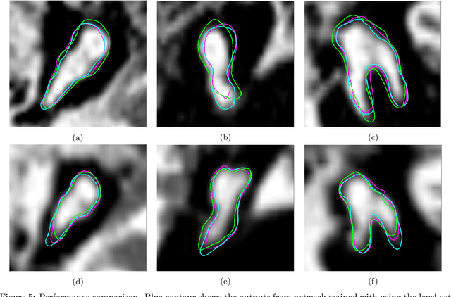 Figure 4 for Self-supervised Registration and Segmentation of the Ossicles with A Single Ground Truth Label