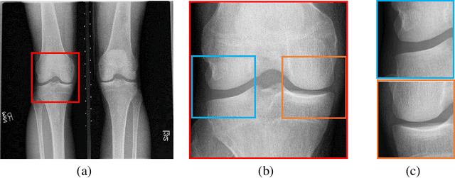 Figure 4 for A Confident Labelling Strategy Based on Deep Learning for Improving Early Detection of Knee OsteoArthritis