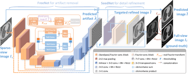 Figure 3 for FreeSeed: Frequency-band-aware and Self-guided Network for Sparse-view CT Reconstruction