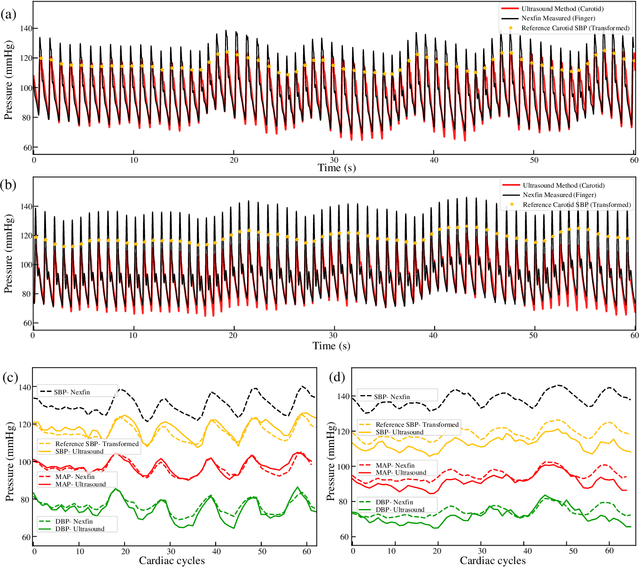 Figure 3 for Continuous and Noninvasive Measurement of Arterial Pulse Pressure and Pressure Waveform using an Image-free Ultrasound System