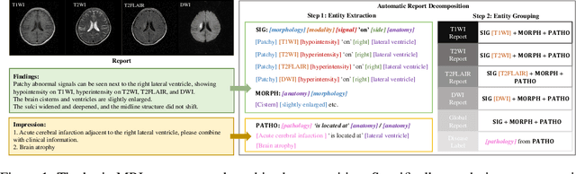 Figure 1 for UniBrain: Universal Brain MRI Diagnosis with Hierarchical Knowledge-enhanced Pre-training