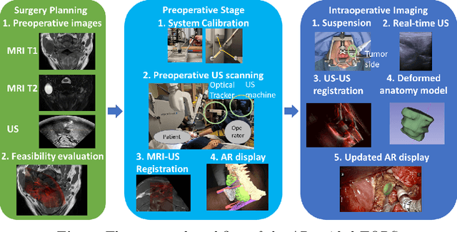 Figure 1 for Transcervical Ultrasound Image Guidance System for Transoral Robotic Surgery