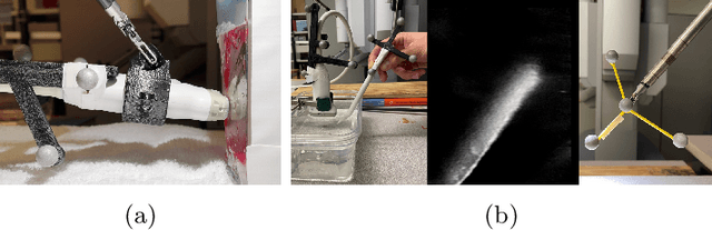 Figure 4 for Transcervical Ultrasound Image Guidance System for Transoral Robotic Surgery