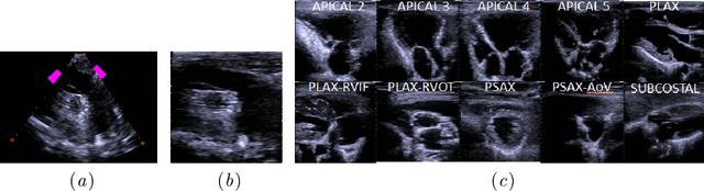 Figure 1 for View Classification and Object Detection in Cardiac Ultrasound to Localize Valves via Deep Learning