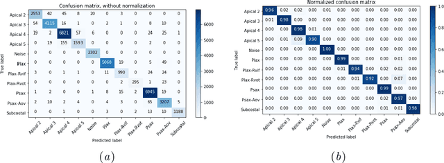 Figure 3 for View Classification and Object Detection in Cardiac Ultrasound to Localize Valves via Deep Learning