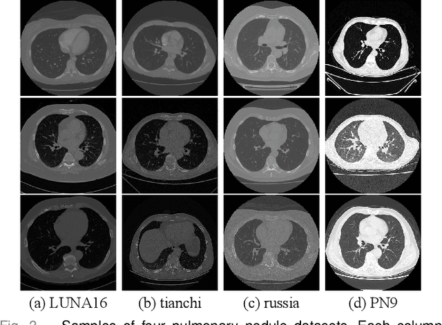 Figure 3 for Unsupervised Cross-domain Pulmonary Nodule Detection without Source Data