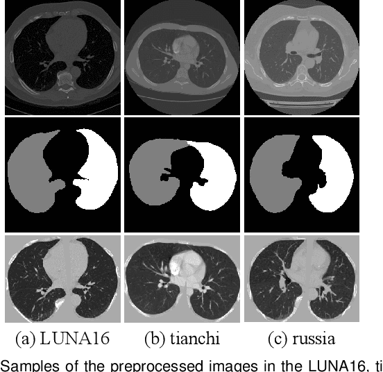 Figure 4 for Unsupervised Cross-domain Pulmonary Nodule Detection without Source Data