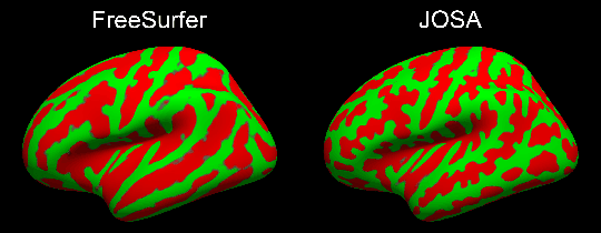 Figure 4 for Joint cortical registration of geometry and function using semi-supervised learning