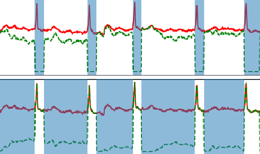 Figure 4 for Pretraining ECG Data with Adversarial Masking Improves Model Generalizability for Data-Scarce Tasks