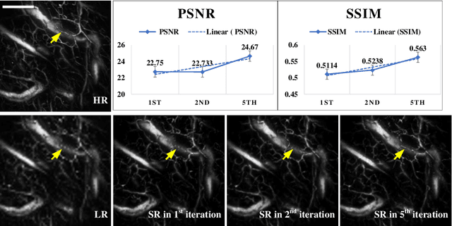 Figure 4 for Iterative-in-Iterative Super-Resolution Biomedical Imaging Using One Real Image