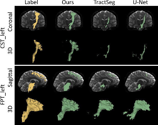 Figure 4 for A Registration- and Uncertainty-based Framework for White Matter Tract Segmentation With Only One Annotated Subject