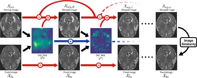 Figure 1 for Unsupervised Segmentation of Fetal Brain MRI using Deep Learning Cascaded Registration