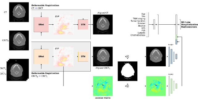 Figure 1 for Comparing 3D deformations between longitudinal daily CBCT acquisitions using CNN for head and neck radiotherapy toxicity prediction