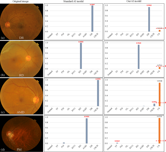 Figure 4 for Uncertainty-inspired Open Set Learning for Retinal Anomaly Identification
