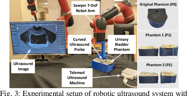 Figure 3 for Robotic Sonographer: Autonomous Robotic Ultrasound using Domain Expertise in Bayesian Optimization