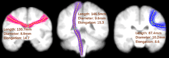 Figure 3 for Fiber Tract Shape Measures Inform Prediction of Non-Imaging Phenotypes