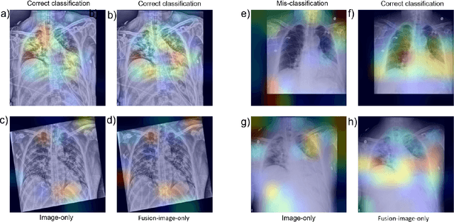 Figure 4 for DeepCOVID-Fuse: A Multi-modality Deep Learning Model Fusing Chest X-Radiographs and Clinical Variables to Predict COVID-19 Risk Levels