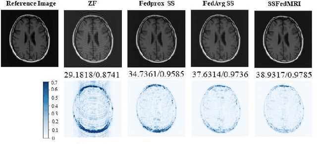 Figure 4 for Self-Supervised Federated Learning for Fast MR Imaging