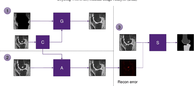 Figure 1 for Automated anomaly-aware 3D segmentation of bones and cartilages in knee MR images from the Osteoarthritis Initiative