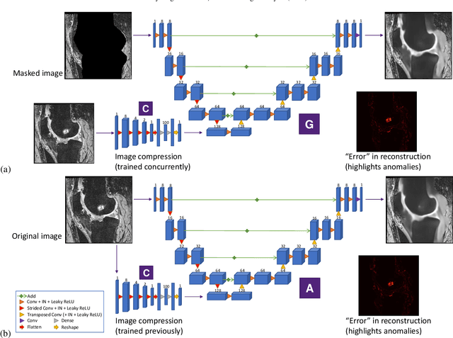 Figure 3 for Automated anomaly-aware 3D segmentation of bones and cartilages in knee MR images from the Osteoarthritis Initiative