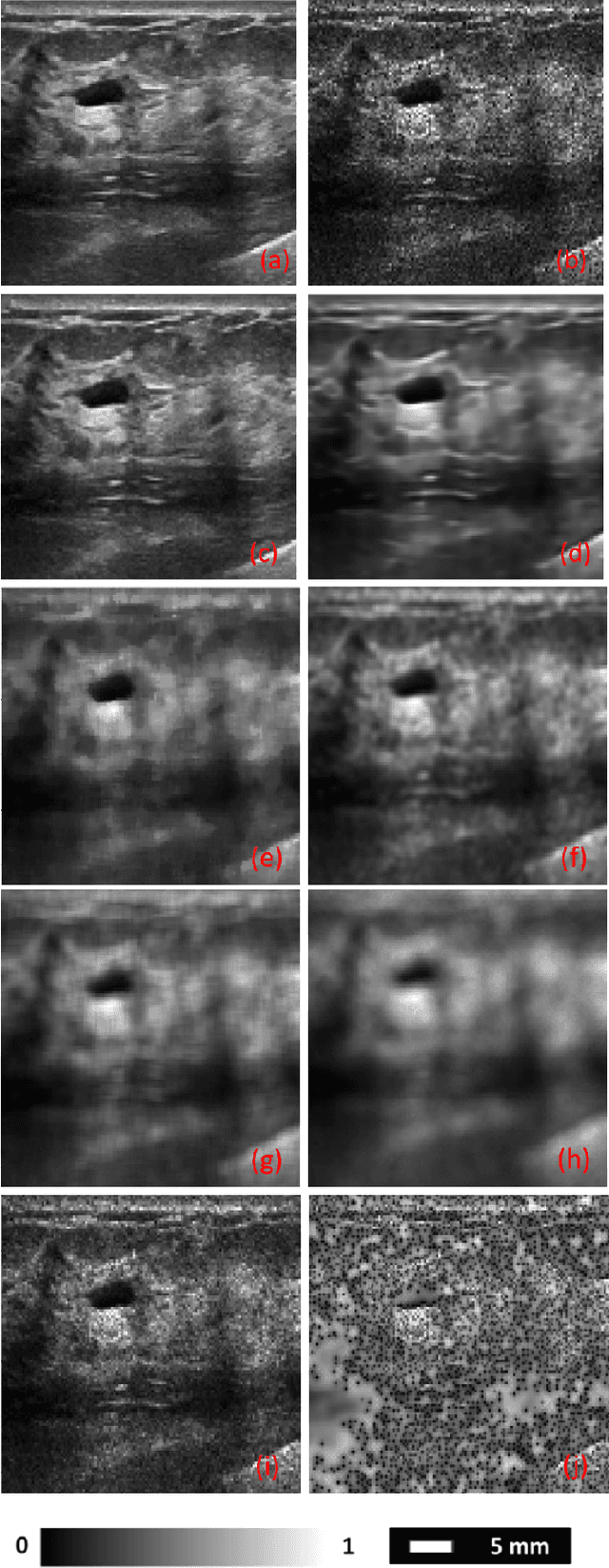 Figure 2 for Speckle Noise Reduction in Ultrasound Images using Denoising Auto-encoder with Skip Connection