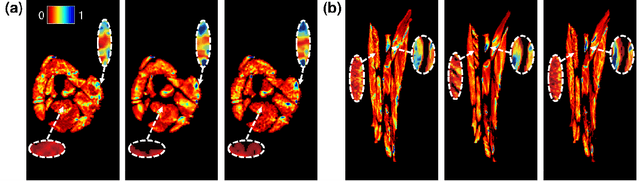 Figure 2 for Farthest Streamline Sampling for the Uniform Distribution of Forearm Muscle Fiber Tracts from Diffusion Tensor Imaging