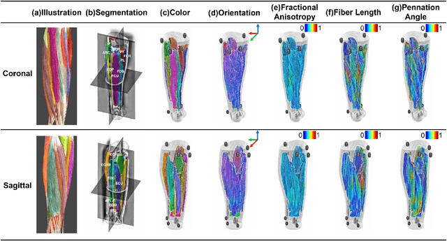 Figure 4 for Farthest Streamline Sampling for the Uniform Distribution of Forearm Muscle Fiber Tracts from Diffusion Tensor Imaging