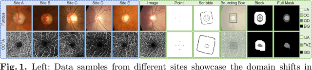 Figure 1 for Unifying and Personalizing Weakly-supervised Federated Medical Image Segmentation via Adaptive Representation and Aggregation