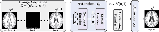 Figure 3 for SADM: Sequence-Aware Diffusion Model for Longitudinal Medical Image Generation