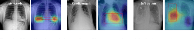 Figure 1 for Attention Mechanisms in Medical Image Segmentation: A Survey