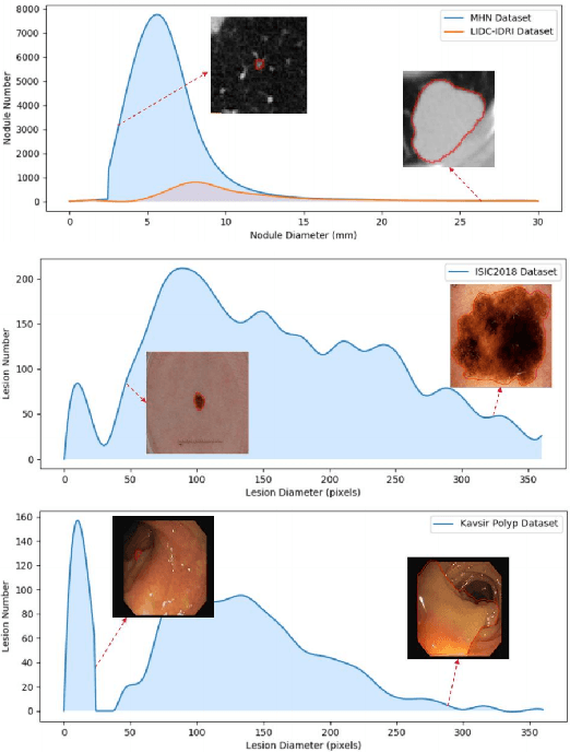Figure 1 for Scale-aware Super-resolution Network with Dual Affinity Learning for Lesion Segmentation from Medical Images