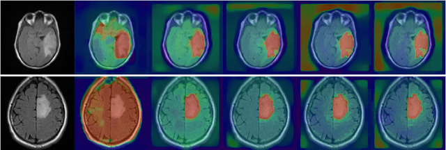 Figure 3 for Chan-Vese Attention U-Net: An attention mechanism for robust segmentation