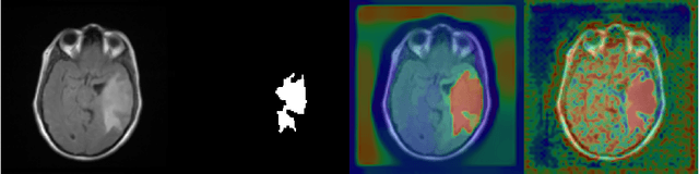 Figure 4 for Chan-Vese Attention U-Net: An attention mechanism for robust segmentation