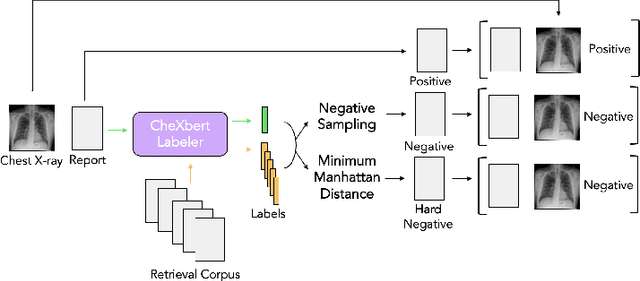 Figure 3 for Multimodal Image-Text Matching Improves Retrieval-based Chest X-Ray Report Generation