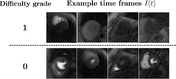 Figure 3 for Temporal Uncertainty Localization to Enable Human-in-the-loop Analysis of Dynamic Contrast-enhanced Cardiac MRI Datasets