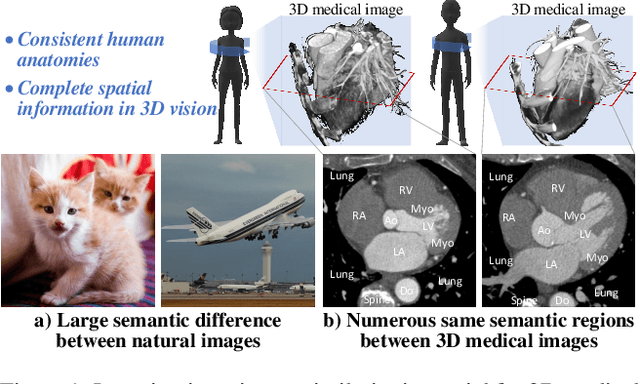 Figure 1 for Geometric Visual Similarity Learning in 3D Medical Image Self-supervised Pre-training