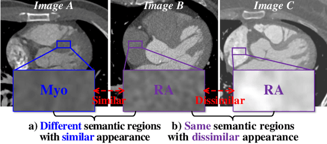 Figure 3 for Geometric Visual Similarity Learning in 3D Medical Image Self-supervised Pre-training