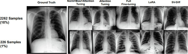 Figure 3 for Parameter-Efficient Fine-Tuning for Medical Image Analysis: The Missed Opportunity
