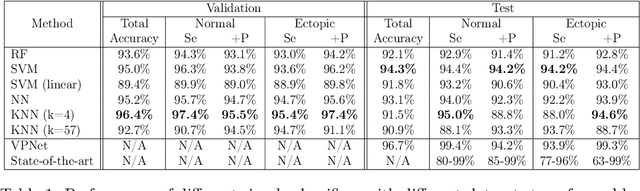 Figure 2 for Learning ECG signal features without backpropagation