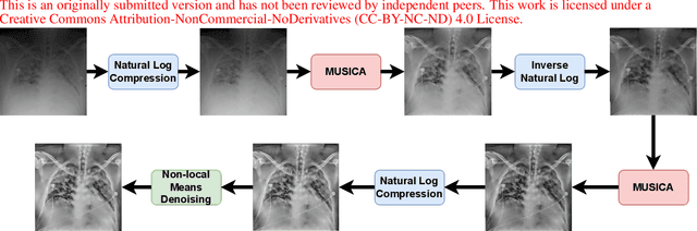 Figure 1 for On The Application Of Log Compression and Enhanced Denoising In Contrast Enhancement Of Digital Radiography Images