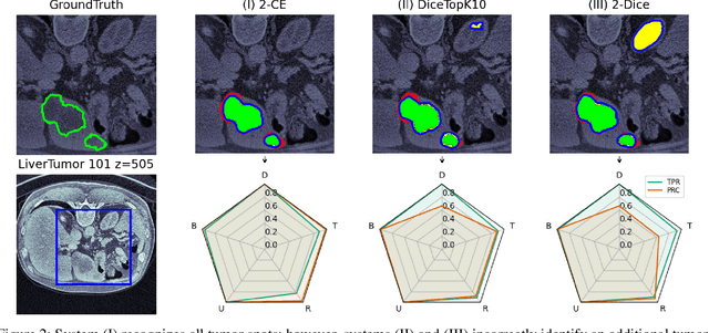 Figure 3 for Multi-Modal Evaluation Approach for Medical Image Segmentation